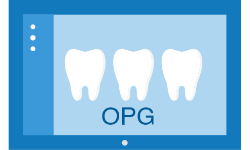 عکس دندان(OPG)