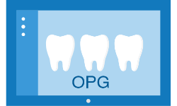 عکس دندان (OPG)