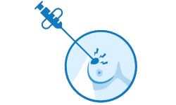وکیوم بیوپسی (پستان)