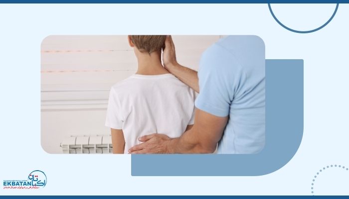 آیا بیماری اسکولیوز به فرزند منتقل می‌شود؟ آنچه باید بدانید