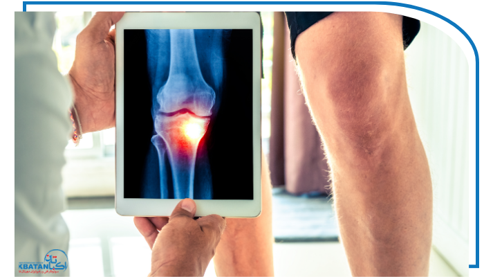 آیا درد زانو در کودکان همیشه نشانه مشکل جدی است؟