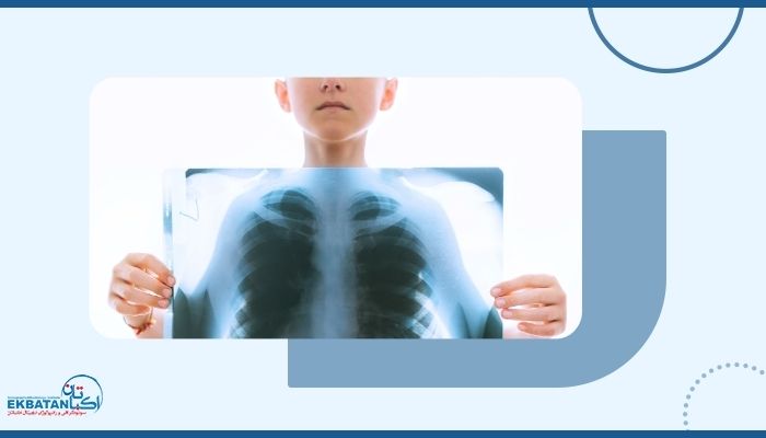 آیا دفرمیتی قفسه سینه در کودکان قابل اصلاح است؟