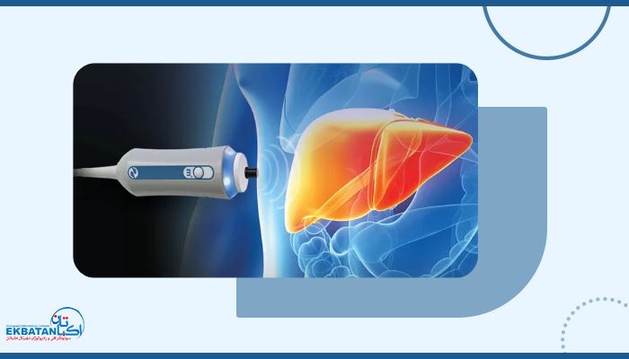 آیا فیبرواسکن کبد جایگزین بیوپسی است؟ آنچه باید بدانید