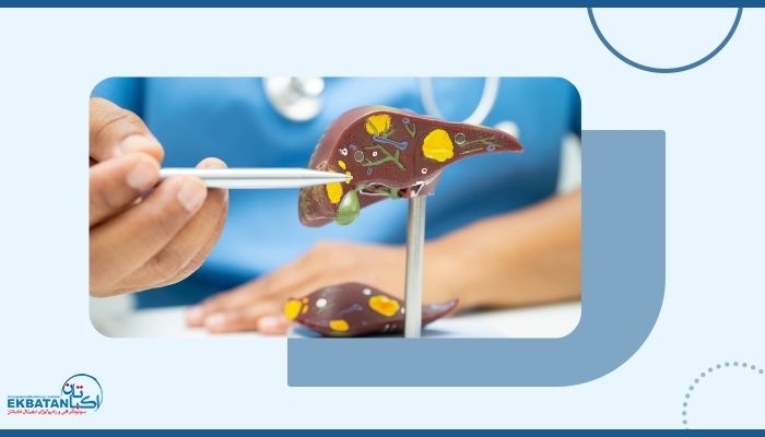 آیا کبد چرب همیشه خطرناک است؟ آنچه باید بدانید