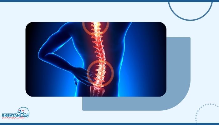 از کجا بفهمیم ستون فقرات دچار انحراف شده است یا خیر؟