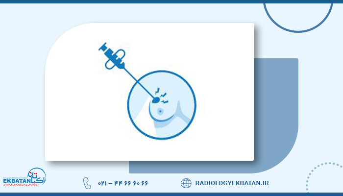 بهترین مرکز برای وکیوم بیوپسی پستان درغرب تهران