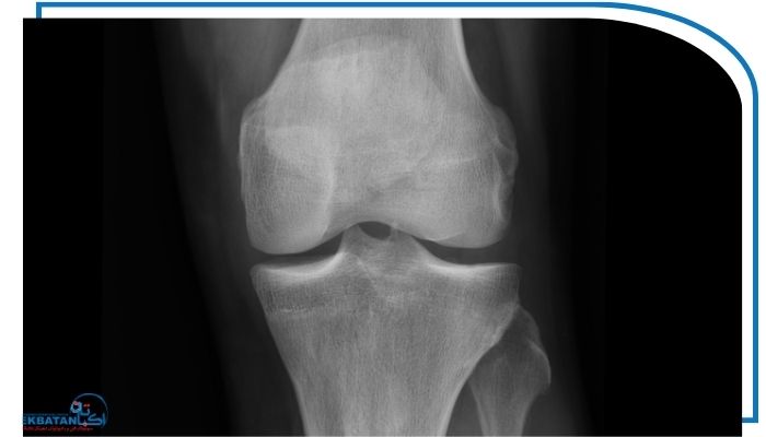 رادیوگرافی تری جوینت در چه شرایطی ضروری است؟