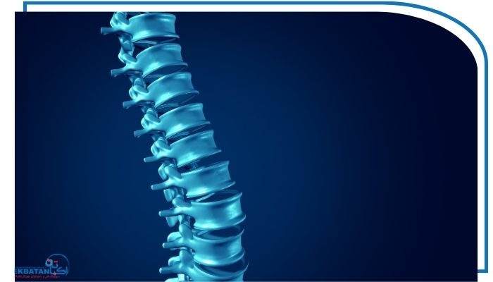 روش‌های تشخیص انحراف در ستون فقرات
