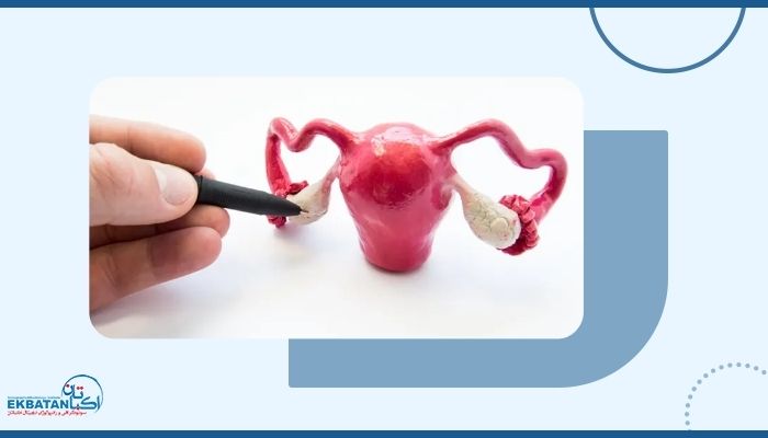 سونوگرافی داپلر رحم چه کمکی به بررسی علت ناباروری می‌کند؟