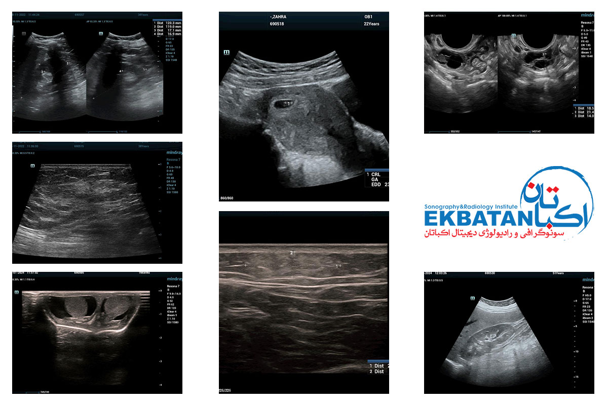 تصاویر سونوگرافی