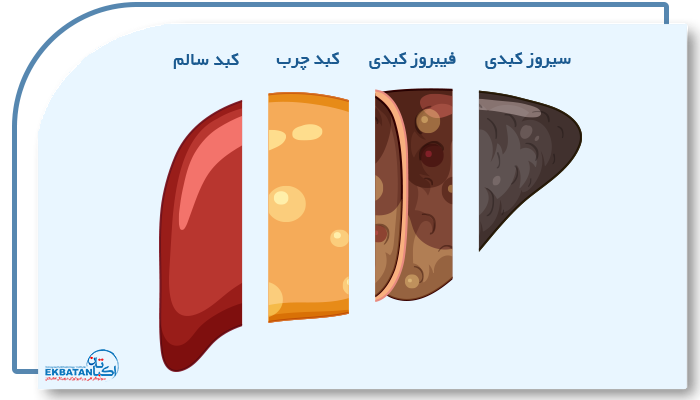 مراحل آسیب کبد