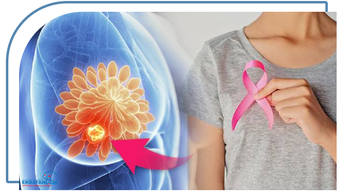 تشخیص سرطان پستان با سونو