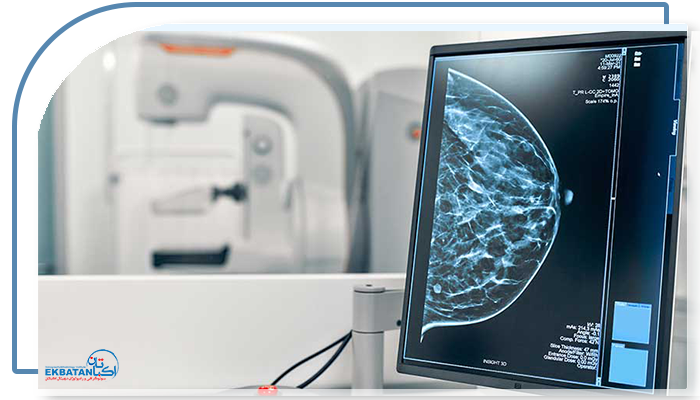 نحوه آمادگی برای ماموگرافی