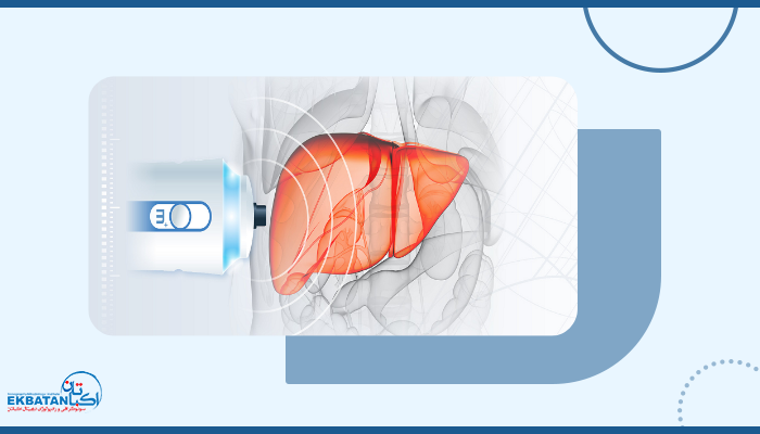 هزینه فیبرو اسکن کبد با بیمه در سال 1403