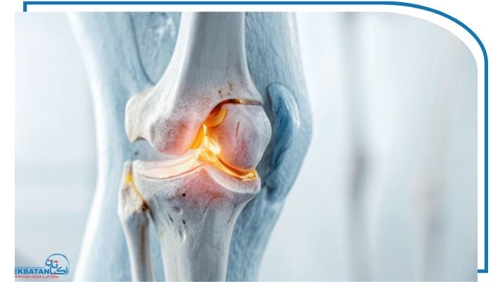 هزینه و پوشش بیمه در رادیوگرافی tree joint