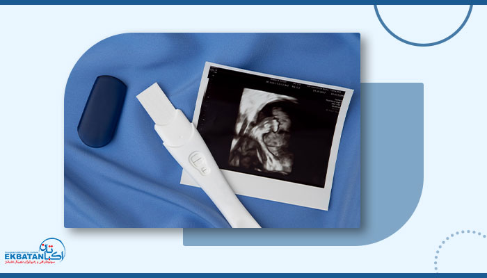 سونوگرافی بارداری و هر آنچه لازم است بدانید!