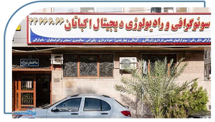 چرا مرکز اکباتان 