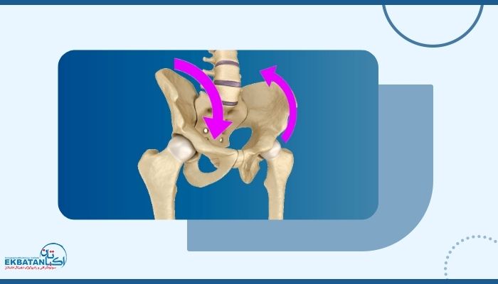چرخش لگن چه علائمی دارد و از کجا بفهمیم لگن ما چرخیده است؟