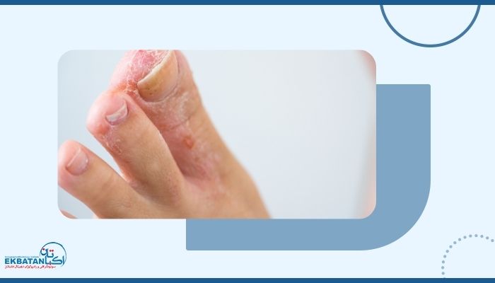 چه تغییری در شکل پا می‌تواند نشانه بیماری و مشکل باشد؟