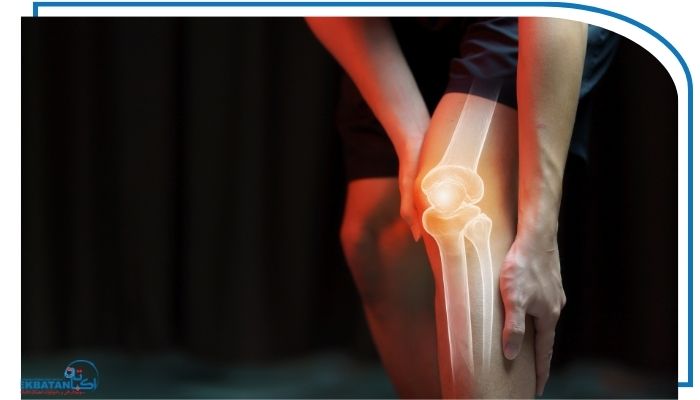 چه کسانی بیشتر به این رادیوگرافی نیاز دارند؟