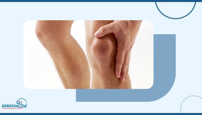 کجی زانو تا چه حد خطرناک است و چگونه تشخیص داده می‌شود؟